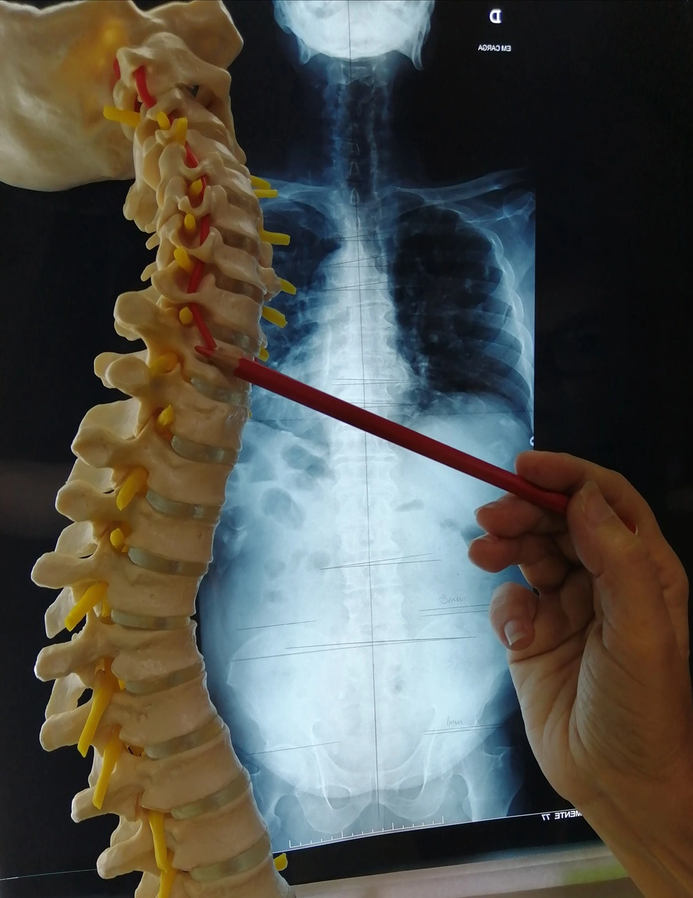 Componente Física para prevenir o cancro - Artigo os 3 fatores essenciais para prevenir o cancro - Centro Quiroprático Nova Vida