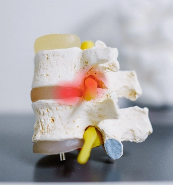 Subluxação vertebral - Blog de Saúde Física e Quiroprática