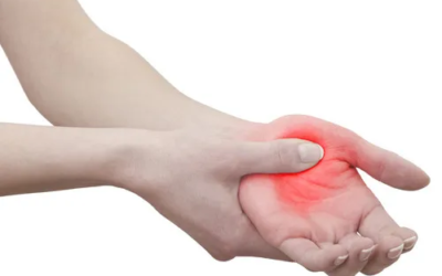 Quiroprática e Artrite Reumatoide: Aliados no Alívio da Dor